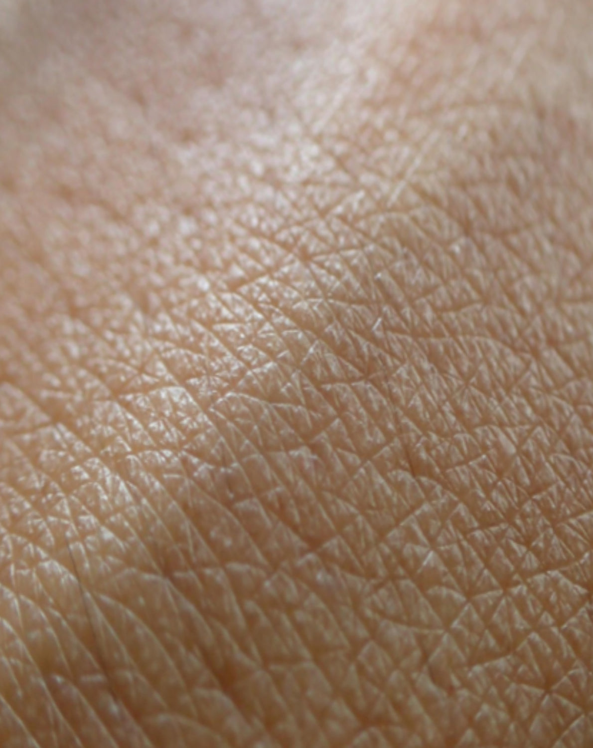 General Dermatology