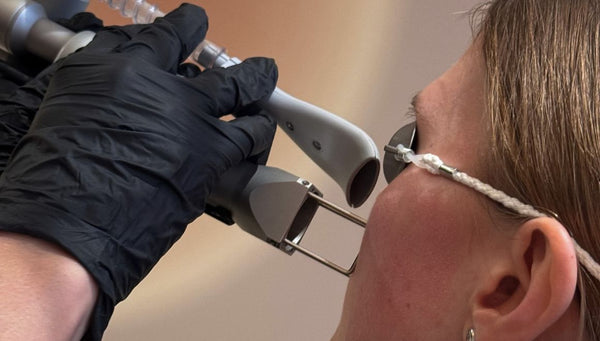 Pigmentflecken behandeln: Ein umfassender Ratgeber von Dr. Anne Gürtler